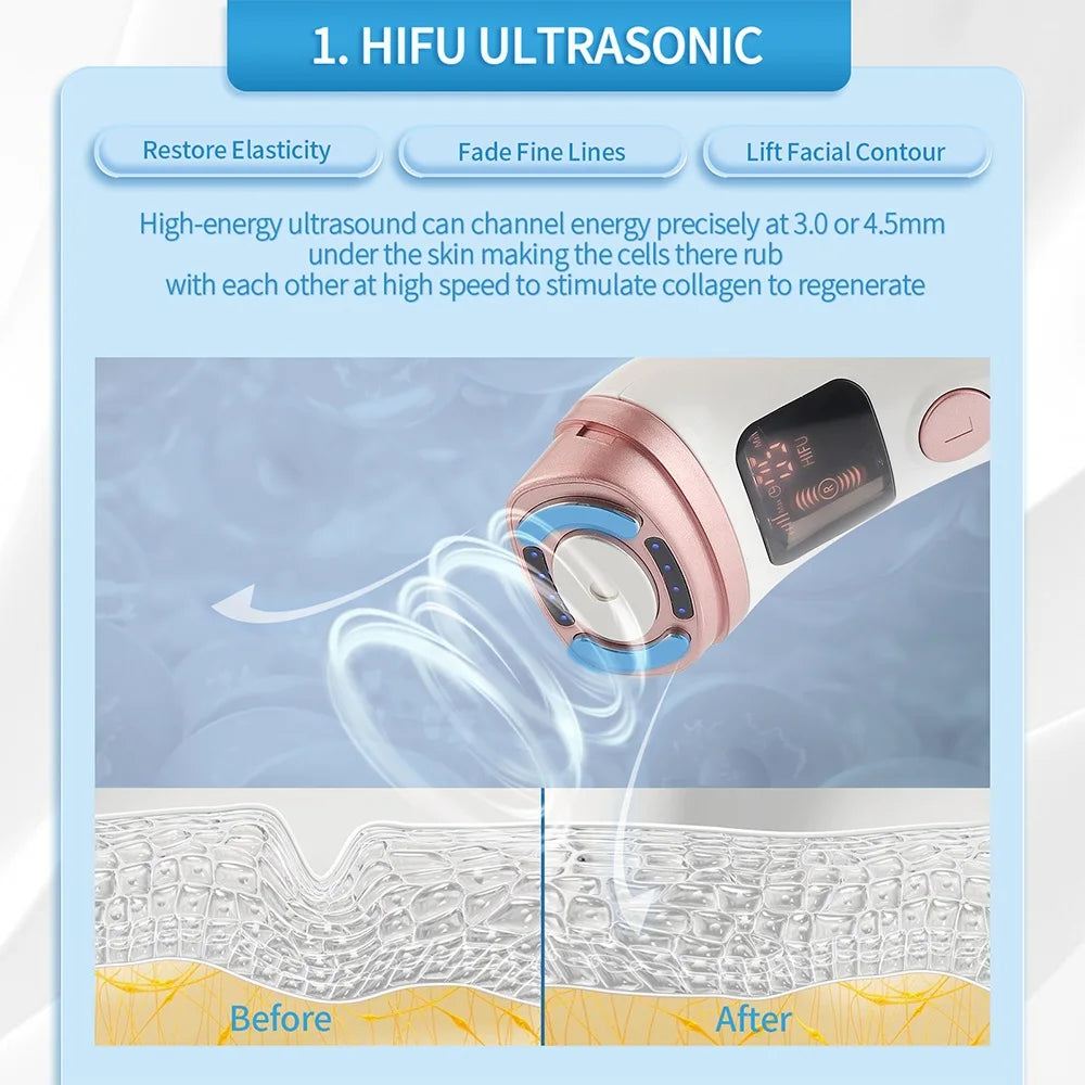 The Haute Lift – Mini HIFU Facial Sculptor